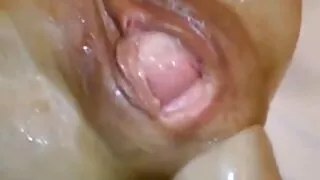 সেক্সট্রাক্টিভ লাল ক ...