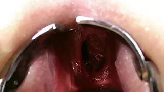 মিল্ফ এসকর্ট সামার স ...